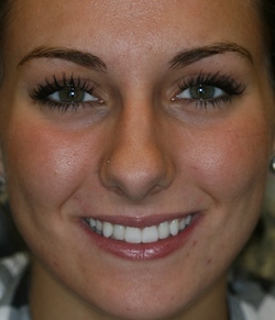 BAGLEY|LINDSEY| girl smiling